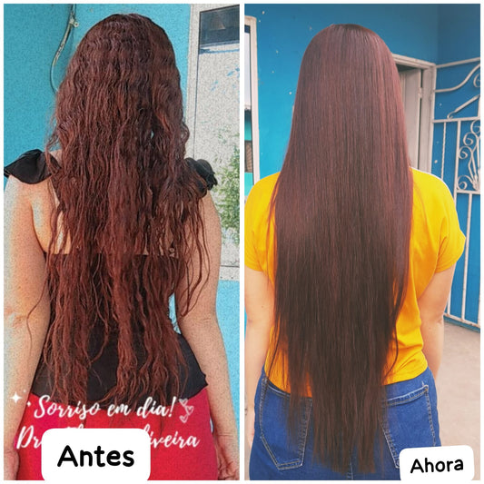 Combo Anticaspa y Anticaída