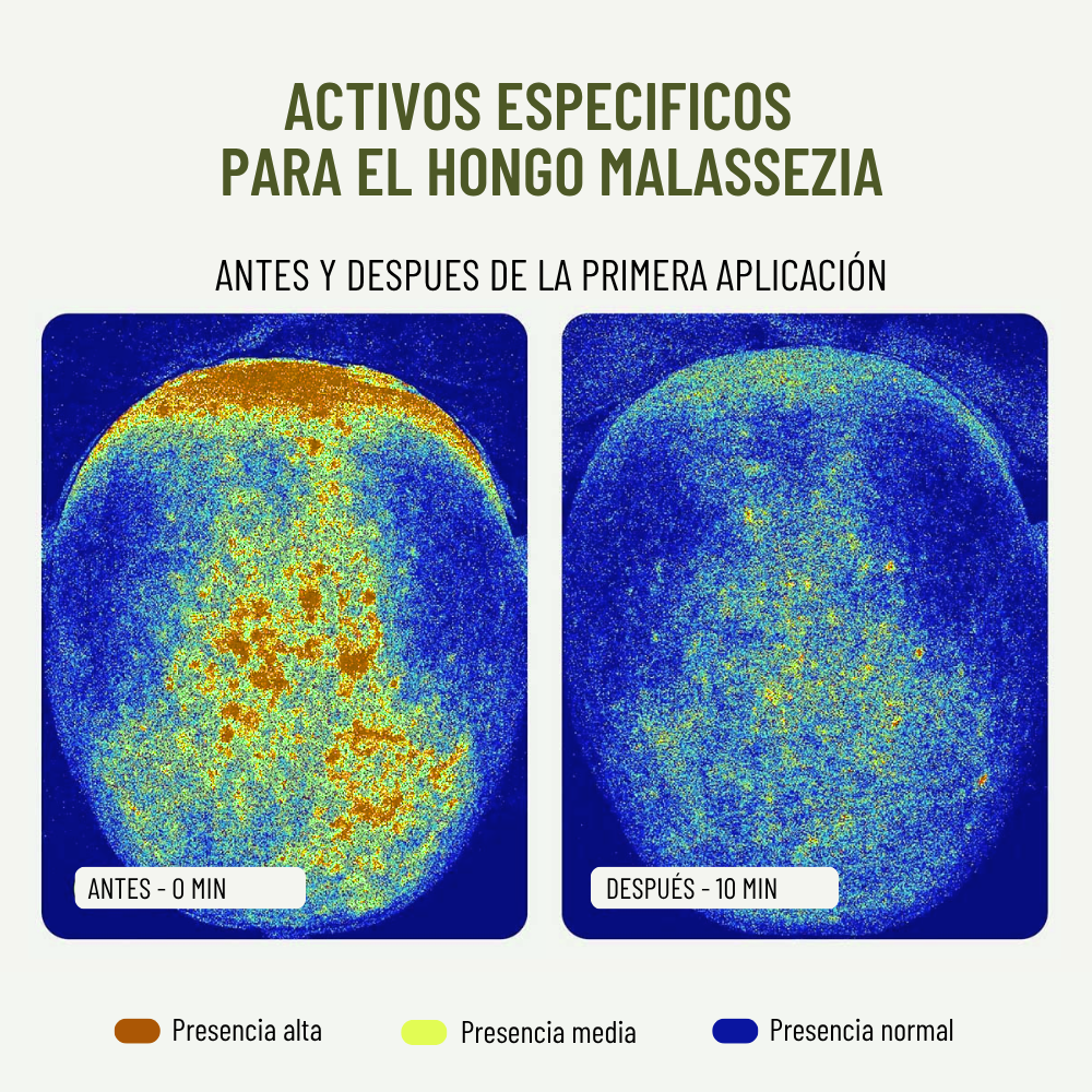 Kit Bio-caspa