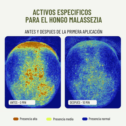Kit Bio-caspa
